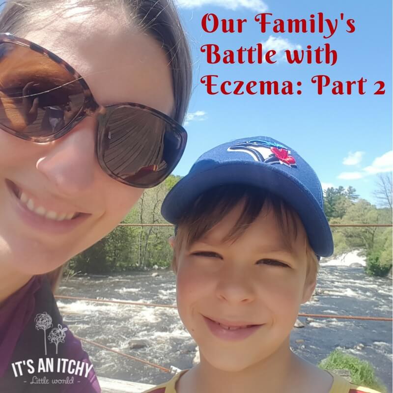Our Family's Battle with Eczema 2