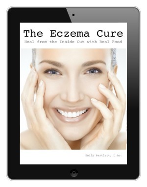Eczema Cure eBook by Holistic Squid