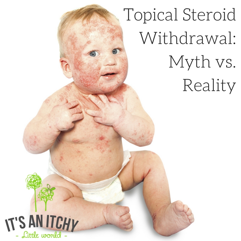 Steroid withdrawal topical What is