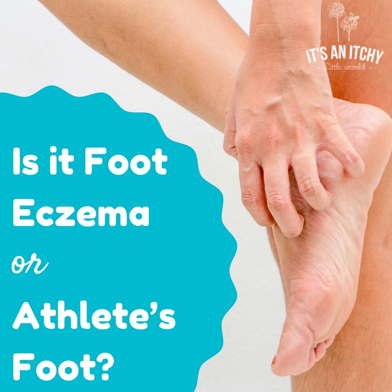 foot eczema - main