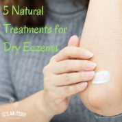 natural treatments for dry eczema