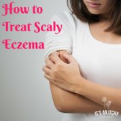 scaly eczema