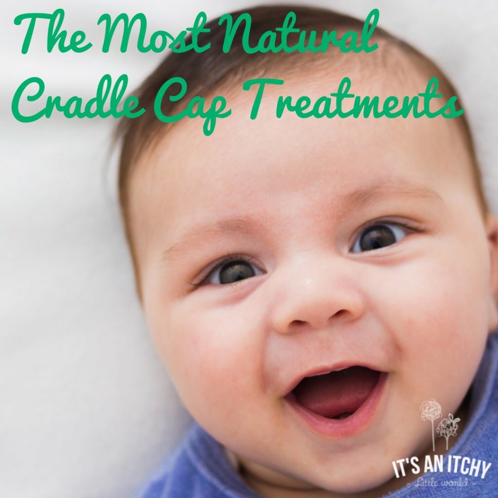 Natural Cradle Cap Treatments