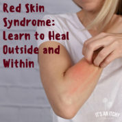 Red Skin Syndrome