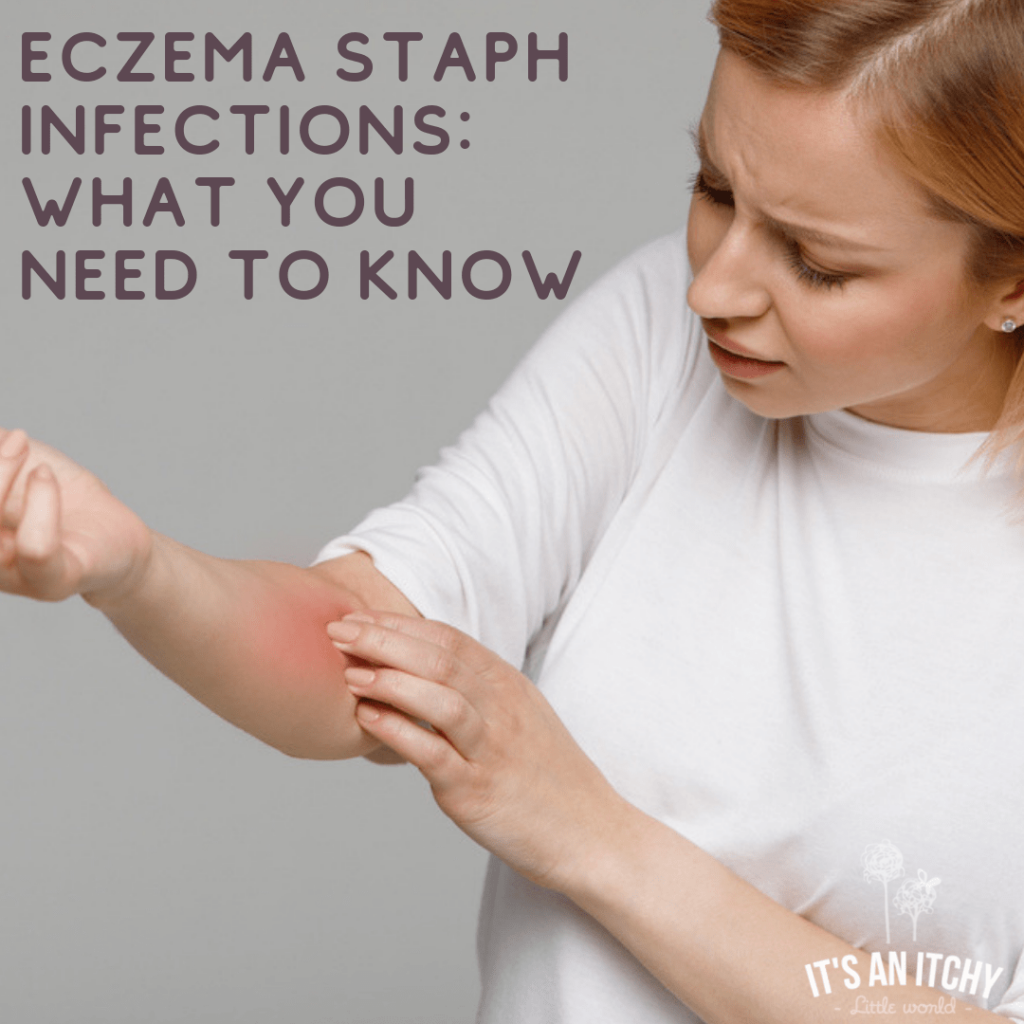 Eczema Staph Infections - girl scratching her red arm